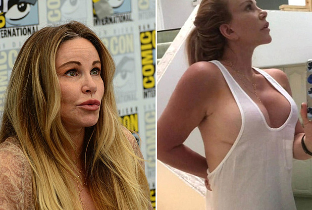 Roky se zohyzděnými ňadry na sklonku života herečku trápily