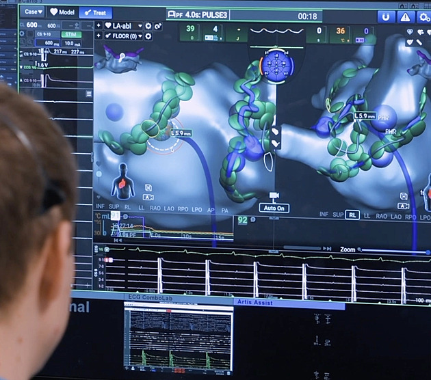 Když srdce zlobí. Moderní zákrok dokáže během hodiny zastavit arytmii