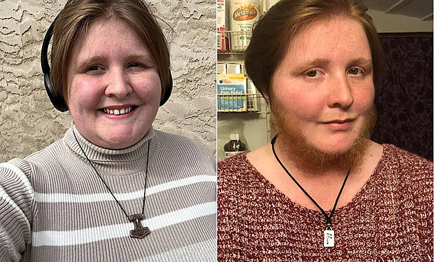 Když se neholím, muži o mě mají větší zájem, říká žena